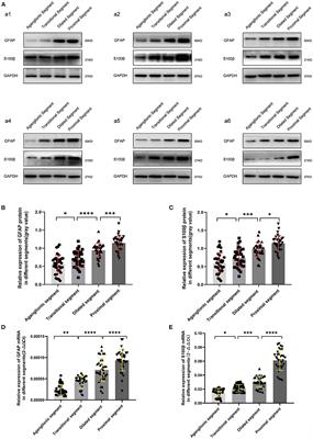 Aberrant Development of Enteric Glial Cells in the Colon of Hirschsprung's Disease